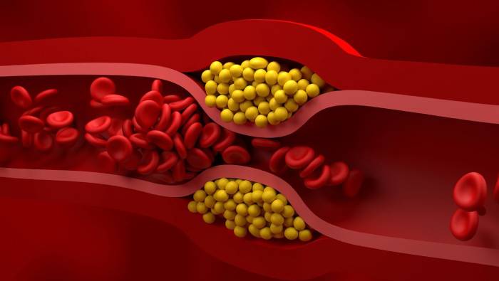 Bad Cholesterol : చెడు కొలెస్ట్రాల్ను కరిగించే చిట్కా.. మన ఇంట్లోనే..! Bad Cholesterol : చెడు కొలెస్ట్రాల్ను కరిగించే చిట్కా.. మన ఇంట్లోనే..!