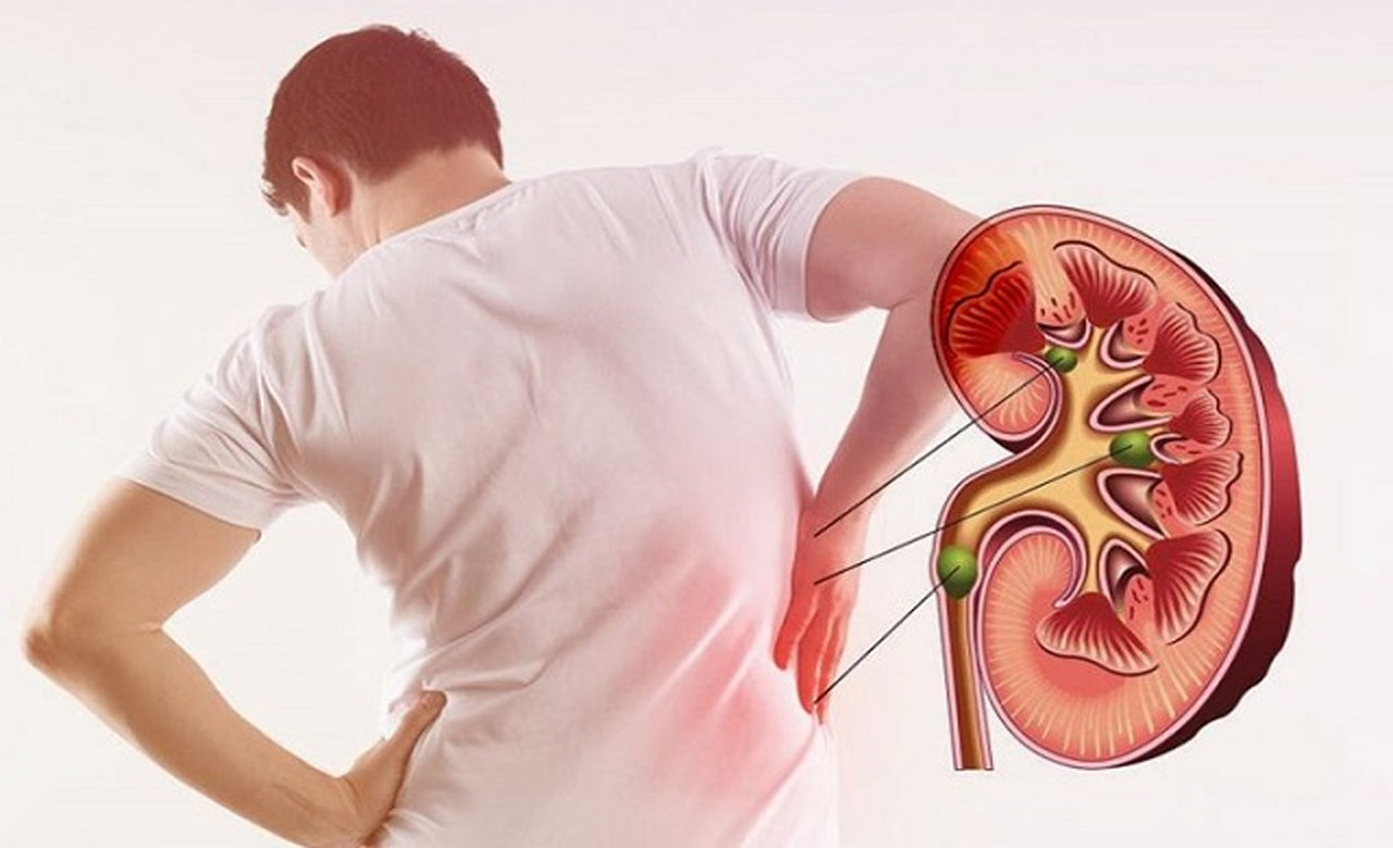 Kidney Stone Risk: ఎండాకాలంలో కిడ్నీలో రాళ్ల సమస్య ఎందుకు పెరుగుతుంది? నివారణ చర్యలు..! Kidney Stone Risk: ఎండాకాలంలో కిడ్నీలో రాళ్ల సమస్య ఎందుకు పెరుగుతుంది? నివారణ చర్యలు..!