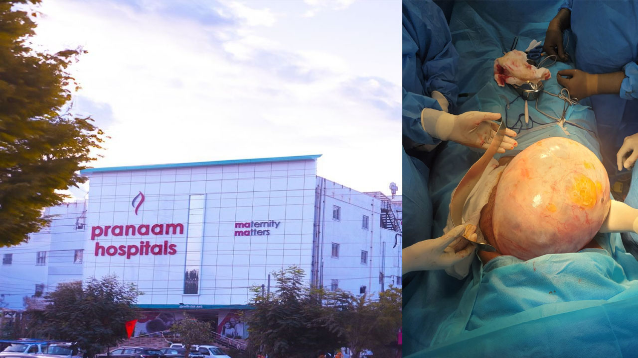 Pranaam Hospitals: శస్త్రచికిత్సలో ప్రణా ఆస్పత్రి భేష్.. 8.5 కిలోల కణితి తొలగింపు.. Pranaam Hospitals: శస్త్రచికిత్సలో ప్రణా ఆస్పత్రి భేష్.. 8.5 కిలోల కణితి తొలగింపు..